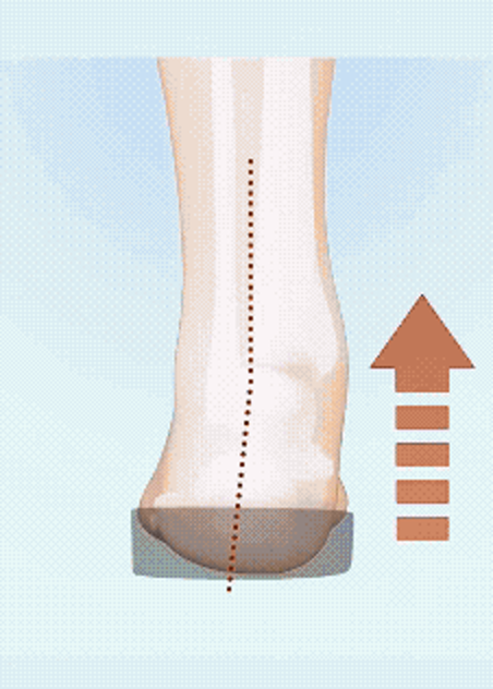 The same leg, an arrow pushing up under the arch