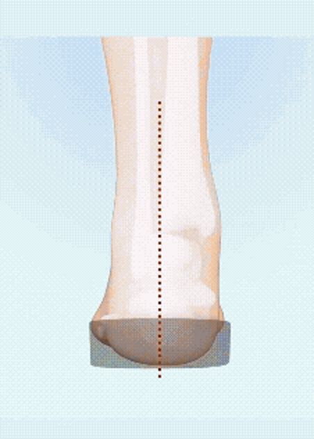 The same leg, the dotted axis now straight over the support