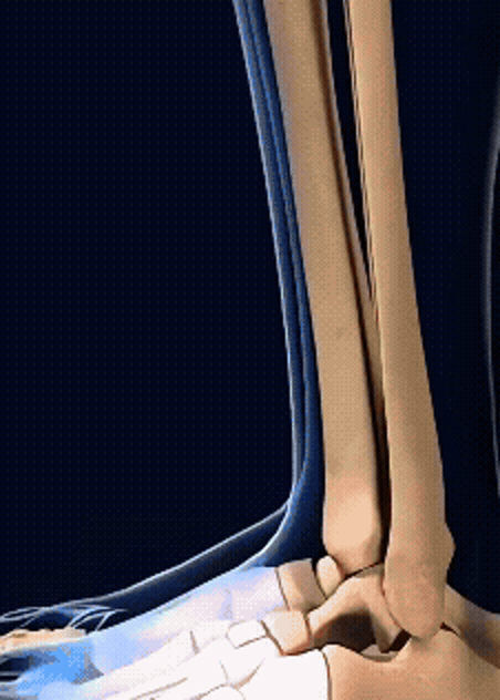 Translucent legs with the bones glowing